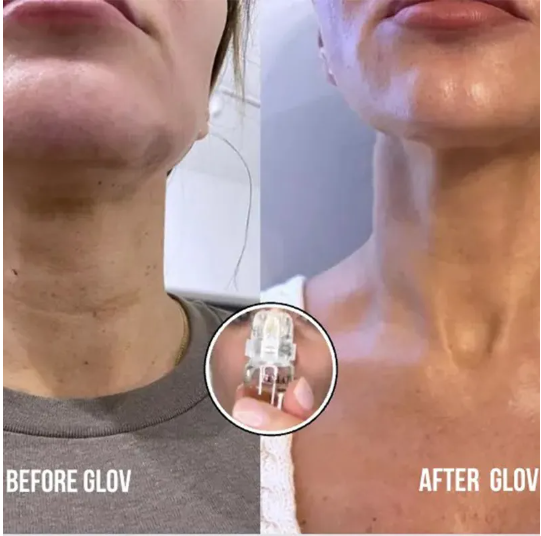 Elasticity Boost Microneedle Serum